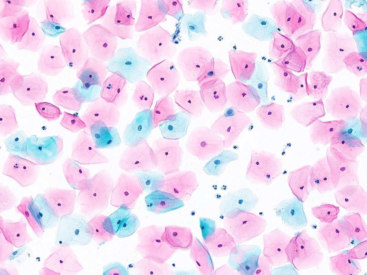 1750836361213922.jpg TCT_1200 900 X.jpg