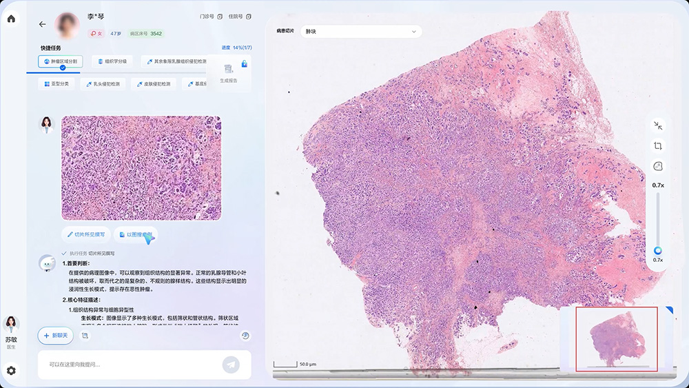 RuiPath Pathology Model Open-Source Launch.jpg RuiPath Pathology Model Open-Source Launch.jpg